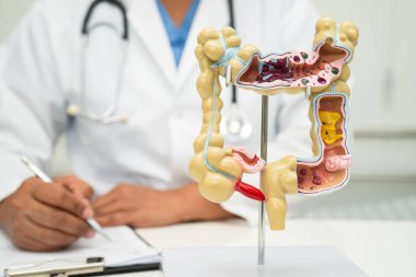 Bağırsak, apandis ve sindirim sistemi, hastanede teşhis ve tedavi için anatomi modelini tutan doktor..