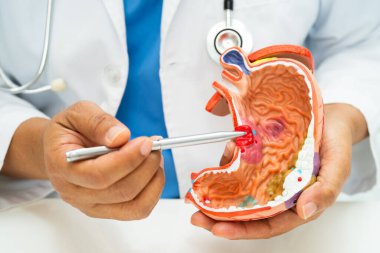 Mide hastalığı, hastanede teşhis ve tedavi için insan anatomisi modeli olan bir doktor..