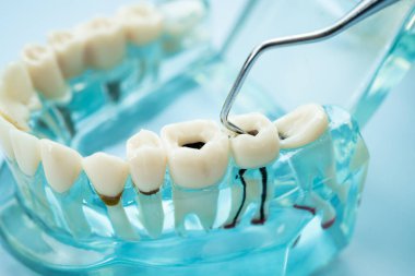 Diş hekimliği için dişçi aracı olan diş modeli.