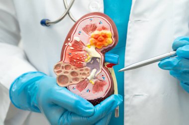 Böbrek hastalığı, Kronik Böbrek Hastalığı, Doktor, hastanede tedavi ve eğitim için insan modeli tutuyor..