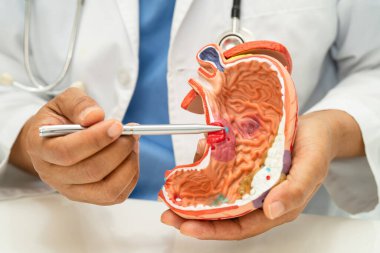 Mide hastalığı, hastanede teşhis ve tedavi için insan anatomisi modeli olan bir doktor..