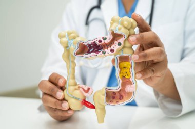 Bağırsak, apandis ve sindirim sistemi, hastanede teşhis ve tedavi için anatomi modelini tutan doktor..