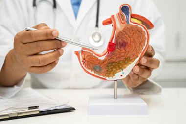 Mide hastalığı, hastanede teşhis ve tedavi için insan anatomisi modeli olan bir doktor..