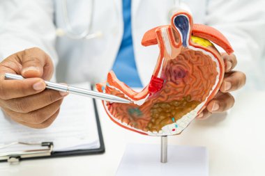 Mide hastalığı, hastanede teşhis ve tedavi için insan anatomisi modeli olan bir doktor..