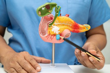 Pankreas iltihabı, pankreas hastası Asyalı doktor, safra kesesi ve safra kesesi insan anatomisi modeli..