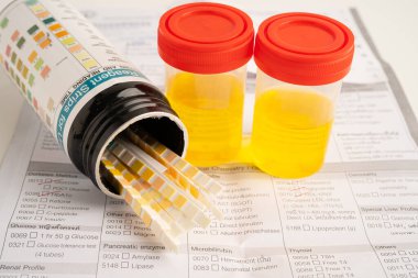 İdrar tahlili, reaksiyonlu idrar kabı. PH kağıt testi ve karşılaştırma tablosu laboratuvarda..