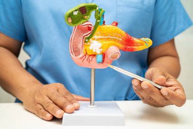 Pankreas iltihabı, pankreas hastası Asyalı doktor, safra kesesi ve safra kesesi insan anatomisi modeli..