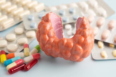 İlaç tedavisi gören tiroid modeli, Hipertiroidizm, Aşırı Aktif veya Lenfoma.