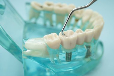 Diş hekimliği için dişçi aracı olan diş modeli.