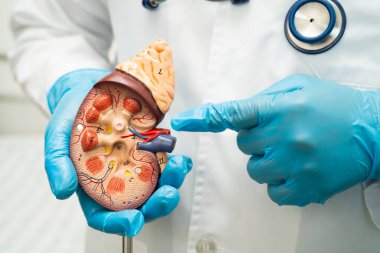 Böbrek hastalığı, Kronik Böbrek Hastalığı, Doktor, hastanede tedavi ve eğitim için insan modeli tutuyor..