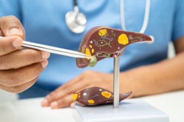 Dünya Hepatit Günü 'nde siroz, karaciğer kanseri, yağlı karaciğer, karaciğer anatomisi olan Asyalı doktor..