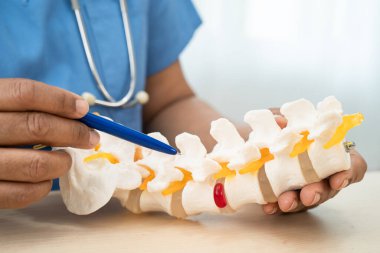 Ortopedi bölümünde tedavi için omurga iskeleti ve sinir modeline sahip bir doktor..