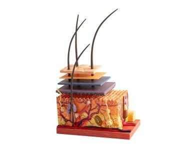 Deri yapısı modeli anatomisi beyaz arka planda izole edilmiş ve klipsli tedavi yolu hastanede, saç nakli.