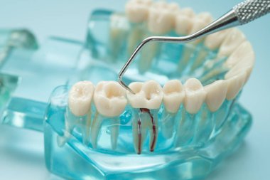 Diş hekimliği için dişçi aracı olan diş modeli.