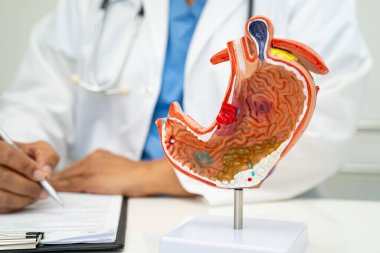 Mide hastalığı, hastanede teşhis ve tedavi için insan anatomisi modeli olan bir doktor..