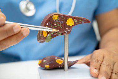 Dünya Hepatit Günü 'nde siroz, karaciğer kanseri, yağlı karaciğer, karaciğer anatomisi olan Asyalı doktor..