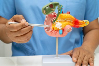 Pankreas iltihabı, pankreas hastası Asyalı doktor, safra kesesi ve safra kesesi insan anatomisi modeli..