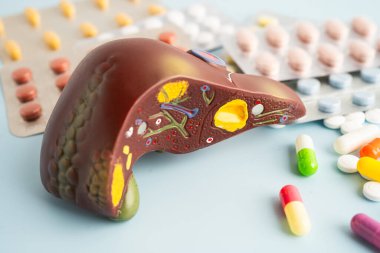 Hap tedavisi gören karaciğer modeli, siroz, karaciğer kanseri, yağlı karaciğer..