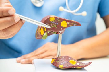 Dünya Hepatit Günü 'nde siroz, karaciğer kanseri, yağlı karaciğer, karaciğer anatomisi olan Asyalı doktor..