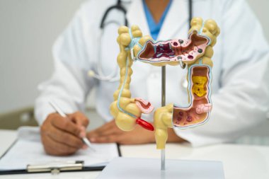 Bağırsak, apandis ve sindirim sistemi, hastanede teşhis ve tedavi için anatomi modelini tutan doktor..
