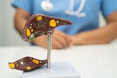 Dünya Hepatit Günü 'nde siroz, karaciğer kanseri, yağlı karaciğer, karaciğer anatomisi olan Asyalı doktor..