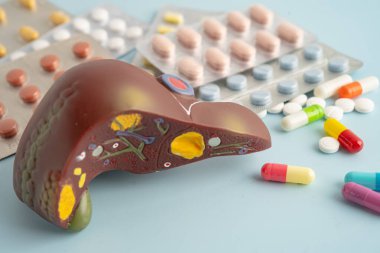 Hap tedavisi gören karaciğer modeli, siroz, karaciğer kanseri, yağlı karaciğer..