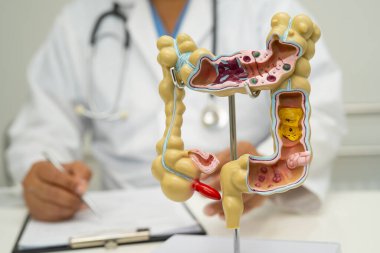 Bağırsak, apandis ve sindirim sistemi, hastanede teşhis ve tedavi için anatomi modelini tutan doktor..