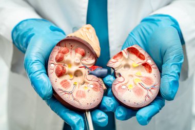 Böbrek hastalığı, Kronik Böbrek Hastalığı, Doktor, hastanede tedavi ve eğitim için insan modeli tutuyor..