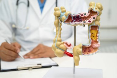 Bağırsak, apandis ve sindirim sistemi, hastanede teşhis ve tedavi için anatomi modelini tutan doktor..