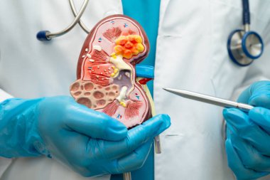 Böbrek hastalığı, Kronik Böbrek Hastalığı, Doktor, hastanede tedavi ve eğitim için insan modeli tutuyor..