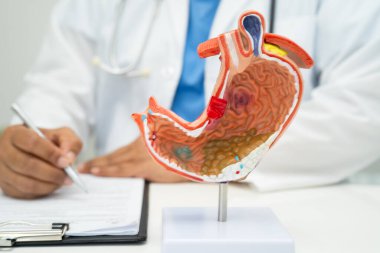 Mide hastalığı, hastanede teşhis ve tedavi için insan anatomisi modeli olan bir doktor..