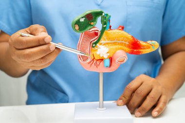 Pankreas iltihabı, pankreas hastası Asyalı doktor, safra kesesi ve safra kesesi insan anatomisi modeli..