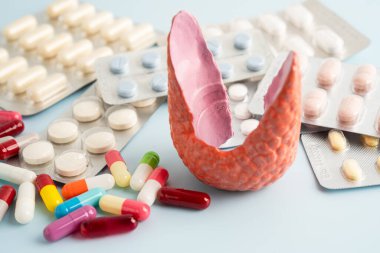 İlaç tedavisi gören tiroid modeli, Hipertiroidizm, Aşırı Aktif veya Lenfoma.