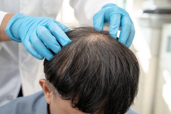 Врач осмотра и лечения Азиатский мужчина лысина проблема волос пациента.