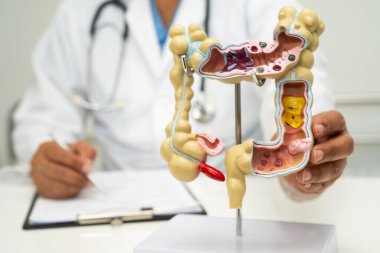 Bağırsak, apandis ve sindirim sistemi, hastanede teşhis ve tedavi için anatomi modelini tutan doktor..