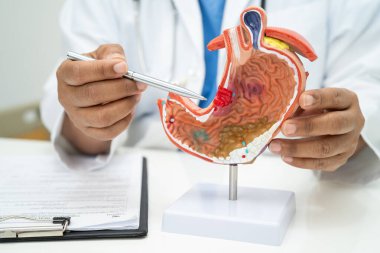 Mide hastalığı, hastanede teşhis ve tedavi için insan anatomisi modeli olan bir doktor..