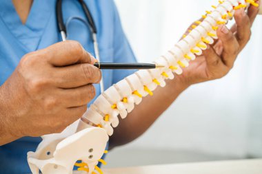 Omurga ve kemik modeli taşıyan Asyalı doktor, ortopedi bölümünde tedavi için bel kemiği yerinden oynamış disk parçası..