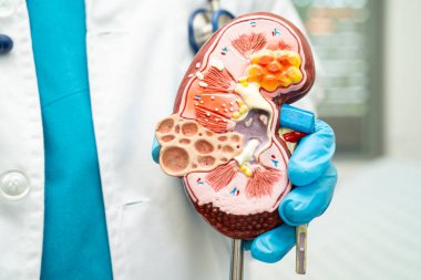 Böbrek hastalığı, Kronik Böbrek Hastalığı, Doktor, hastanede tedavi ve eğitim için insan modeli tutuyor..