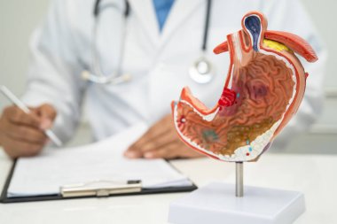 Mide hastalığı, hastanede teşhis ve tedavi için insan anatomisi modeli olan bir doktor..