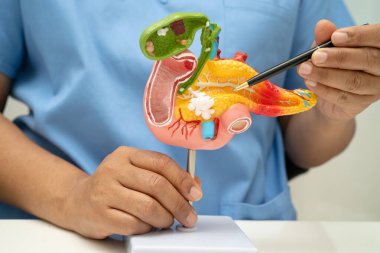 Pankreas iltihabı, pankreas hastası Asyalı doktor, safra kesesi ve safra kesesi insan anatomisi modeli..