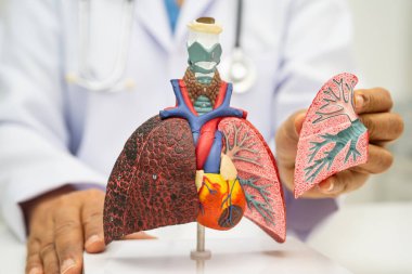 Zatürree, akciğer kanseri, Asyalı doktor hastanede teşhis ve tedavi için insan anatomisi modeli tutuyor.