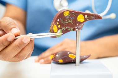 Dünya Hepatit Günü 'nde siroz, karaciğer kanseri, yağlı karaciğer, karaciğer anatomisi olan Asyalı doktor..