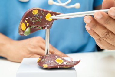 Dünya Hepatit Günü 'nde siroz, karaciğer kanseri, yağlı karaciğer, karaciğer anatomisi olan Asyalı doktor..