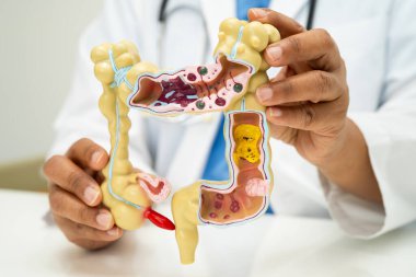 Bağırsak, apandis ve sindirim sistemi, hastanede teşhis ve tedavi için anatomi modelini tutan doktor..