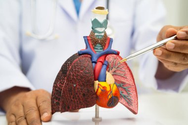 Zatürree, akciğer kanseri, Asyalı doktor hastanede teşhis ve tedavi için insan anatomisi modeli tutuyor.