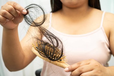 Asyalı kadınların tarak fırçasına eklenen uzun saç kaybıyla ilgili sorunları var..