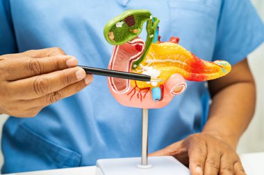 Pankreas iltihabı, pankreas hastası Asyalı doktor, safra kesesi ve safra kesesi insan anatomisi modeli..