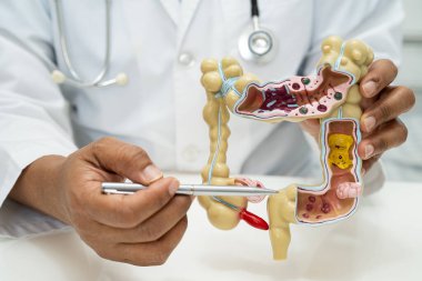 Bağırsak, apandis ve sindirim sistemi, hastanede teşhis ve tedavi için anatomi modelini tutan doktor..