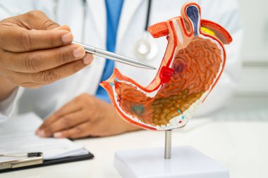 Mide hastalığı, hastanede teşhis ve tedavi için insan anatomisi modeli olan bir doktor..