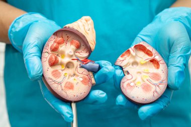 Böbrek hastalığı, Kronik Böbrek Hastalığı, Doktor, hastanede tedavi ve eğitim için insan modeli tutuyor..